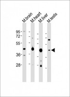 UTF1 Antibody - All lanes: Anti-Utf1 Antibody (C-term) at 1:2000 dilution. Lane 1: mouse brain lysates. Lane 2: mouse heart lysates. Lane 3: mouse liver lysates. Lane 4: mouse testis lysates Lysates/proteins at 20 ug per lane. Secondary Goat Anti-Rabbit IgG, (H+L), Peroxidase conjugated at 1:10000 dilution. Predicted band size: 36 kDa. Blocking/Dilution buffer: 5% NFDM/TBST.