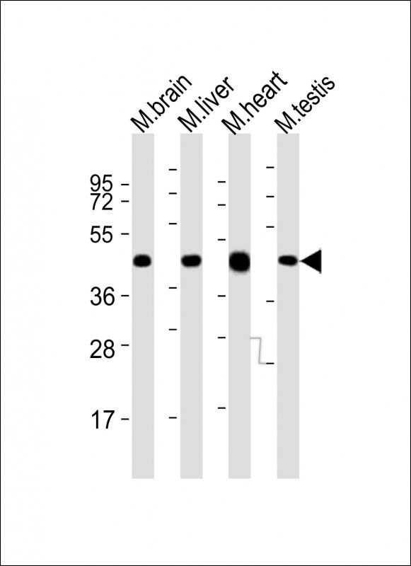 UTF1 Antibody - All lanes : Anti-Utf1 Antibody at 1:2000 dilution Lane 1: mouse brain lysates Lane 2: mouse liver lysates Lane 3: mouse heart lysates Lane 4: mouse testis lysates Lysates/proteins at 20 ug per lane. Secondary Goat Anti-Rabbit IgG, (H+L), Peroxidase conjugated at 1/10000 dilution. Predicted band size : 36 kDa Blocking/Dilution buffer: 5% NFDM/TBST.