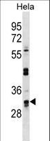 UTP11L Antibody - UTP11L Antibody western blot of HeLa cell line lysates (35 ug/lane). The UTP11L antibody detected the UTP11L protein (arrow).