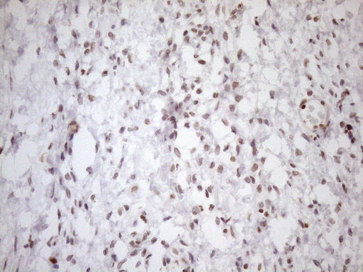 UTP11L Antibody - Immunohistochemical staining of paraffin-embedded Human Ovary tissue within the normal limits using anti-UTP11L mouse monoclonal antibody. (Heat-induced epitope retrieval by 1mM EDTA in 10mM Tris buffer. (pH8.5) at 120°C for 3 min. (1:150)