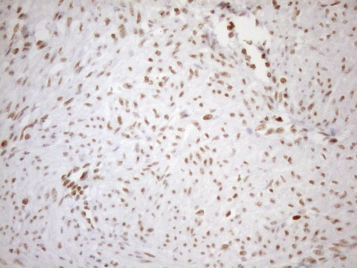 UTP11L Antibody - Immunohistochemical staining of paraffin-embedded Human endometrium tissue within the normal limits using anti-UTP11L mouse monoclonal antibody. (Heat-induced epitope retrieval by 1mM EDTA in 10mM Tris buffer. (pH8.5) at 120°C for 3 min. (1:150)