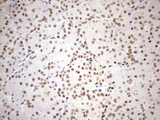 UTP11L Antibody - Immunohistochemical staining of paraffin-embedded Human pancreas tissue within the normal limits using anti-UTP11L mouse monoclonal antibody. (Heat-induced epitope retrieval by 1mM EDTA in 10mM Tris buffer. (pH8.5) at 120°C for 3 min. (1:150)