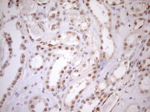 UTP11L Antibody - Immunohistochemical staining of paraffin-embedded Human Kidney tissue within the normal limits using anti-UTP11L mouse monoclonal antibody. (Heat-induced epitope retrieval by 1mM EDTA in 10mM Tris buffer. (pH8.5) at 120°C for 3 min. (1:150)