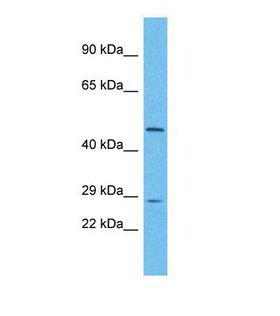 UTP11L Antibody - Western blot of Human HeLa. UTP11L antibody dilution 1.0 ug/ml.  This image was taken for the unconjugated form of this product. Other forms have not been tested.