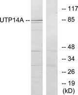 UTP14A Antibody - Western blot analysis of lysates from HeLa cells, using UTP14A Antibody. The lane on the right is blocked with the synthesized peptide.