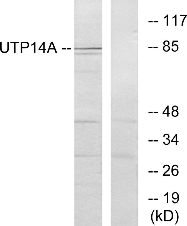 UTP14A Antibody - Western blot analysis of lysates from HeLa cells, using UTP14A Antibody. The lane on the right is blocked with the synthesized peptide.