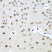 UTP14A Antibody - Immunohistochemistry of paraffin-embedded mouse brain tissue.