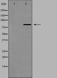 UTP14A Antibody - Western blot analysis of extracts of HeLa cells using UTP14A antibody. The lane on the left is treated with the antigen-specific peptide.