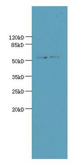 UTP15 Antibody - Western blot. All lanes: UTP15 antibody at 5 ug/ml. Lane 1: HeLa whole cell lysate. Lane 2: HepG-2 whole cell lysate. Secondary Goat polyclonal to Rabbit IgG at 1:10000 dilution. Predicted band size: 58 kDa. Observed band size: 58 kDa.