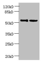 UTP15 Antibody - Western blot All lanes: UTP15 antibody at 5µg/ml Lane 1: Hela whole cell lysate Lane 2: HepG2 whole cell lysate Secondary Goat polyclonal to rabbit IgG at 1/10000 dilution Predicted band size: 59, 37, 57 kDa Observed band size: 59 kDa