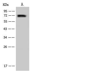 UTP18 Antibody - Anti-UTP18 rabbit polyclonal antibody at 1:500 dilution. Lane A: U-251 MG Whole Cell Lysate. Lysates/proteins at 30 ug per lane. Secondary: Goat Anti-Rabbit IgG (H+L)/HRP at 1/10000 dilution. Developed using the ECL technique. Performed under reducing conditions. Predicted band size: 62 kDa. Observed band size: 70 kDa.
