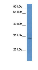 UTP23 Antibody - UTP23 antibody Western blot of Jurkat lysate.  This image was taken for the unconjugated form of this product. Other forms have not been tested.