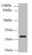 UTP23 Antibody - Western blot All lanes: UTP23 antibody at 7µg/ml + Mouse liver tissue Secondary Goat polyclonal to rabbit IgG at 1/10000 dilution Predicted band size: 29, 17 kDa Observed band size: 29 kDa