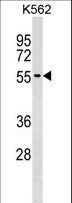 UTP3 / CRLZ1 Antibody - UTP3 Antibody western blot of K562 cell line lysates (35 ug/lane). The UTP3 antibody detected the UTP3 protein (arrow).