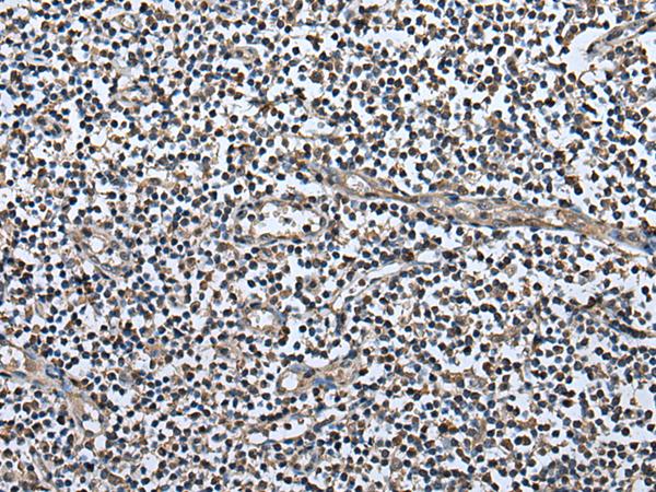 UTP3 / CRLZ1 Antibody - Immunohistochemistry of paraffin-embedded Human tonsil tissue  using UTP3 Polyclonal Antibody at dilution of 1:50(×200)