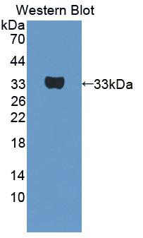 UTRN / Utrophin Antibody - Western blot of UTRN / Utrophin antibody.