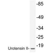 UTS2 / Urotensin II Antibody - Western blot analysis of lysate from 293 cells, using Urotensin II antibody.