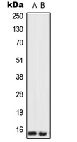 UTS2 / Urotensin II Antibody - Western blot analysis of Urotensin 2 expression in SKBR3 (A); U251MG (B) whole cell lysates.