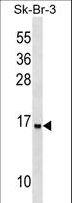 UTS2B / U2B Antibody - UTS2D Antibody western blot of SK-BR-3 cell line lysates (35 ug/lane). The UTS2D antibody detected the UTS2D protein (arrow).