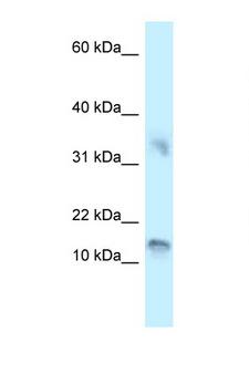 UTS2B / U2B Antibody - UTS2D / Urotensin IIB antibody Western blot of 721_B Cell lysate. Antibody concentration 1 ug/ml.  This image was taken for the unconjugated form of this product. Other forms have not been tested.