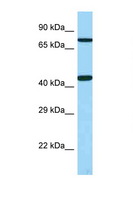 UTS2R / GPR14 Antibody - UTS2R / GPR14 antibody Western blot of Fetal Heart lysate. Antibody concentration 1 ug/ml.  This image was taken for the unconjugated form of this product. Other forms have not been tested.