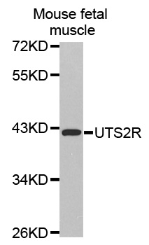 UTS2R / GPR14 Antibody - Western blot analysis of extracts of Mouse fetal muscle tissue lysate.