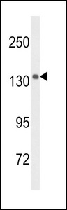 UTY Antibody - Western blot of UTY Antibody in mouse brain tissue lysates (35 ug/lane). UTY (arrow) was detected using the purified antibody.