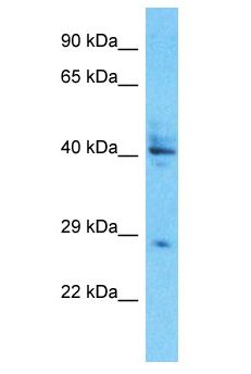 UTY Antibody - UTY antibody Western Blot of A549. Antibody dilution: 1 ug/ml.  This image was taken for the unconjugated form of this product. Other forms have not been tested.