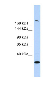UTY Antibody - UTY antibody Western blot of Fetal Brain lysate. This image was taken for the unconjugated form of this product. Other forms have not been tested.