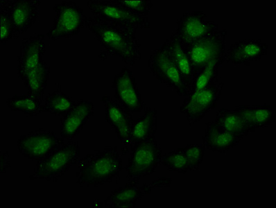 UTY Antibody - Immunofluorescence staining of Hela cells at a dilution of 1:133, counter-stained with DAPI. The cells were fixed in 4% formaldehyde, permeabilized using 0.2% Triton X-100 and blocked in 10% normal Goat Serum. The cells were then incubated with the antibody overnight at 4 °C.The secondary antibody was Alexa Fluor 488-congugated AffiniPure Goat Anti-Rabbit IgG (H+L) .