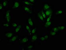 UTY Antibody - Immunofluorescence staining of Hela cells at a dilution of 1:133, counter-stained with DAPI. The cells were fixed in 4% formaldehyde, permeabilized using 0.2% Triton X-100 and blocked in 10% normal Goat Serum. The cells were then incubated with the antibody overnight at 4 °C.The secondary antibody was Alexa Fluor 488-congugated AffiniPure Goat Anti-Rabbit IgG (H+L) .