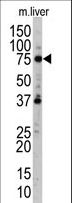 UVRAG Antibody - Western blot of anti-hUVRAG antibody (RB10846) in mouse liver tissue lysate. hUVRAG (arrow) was detected using the purified antibody.