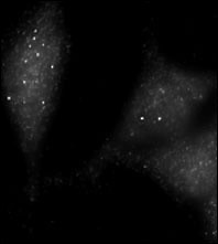 UVRAG Antibody - Immunofluorescence staining of Autophagy UVRAG antibody on Methanol-fixed HeLa cells. Data courtesy of Dr. Eeva-Liisa Eskelinen, University of Helsinki,Finland.