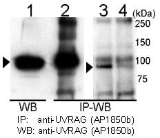 UVRAG Antibody - Immunoprecipitation and western blot of anti-UVRAG antibody in 293T cells. UVRAG is immunoprecipitated (Lane 2) and detected in 293T cell transiently transfected with mouse UVRAG (Lane 1). Detection of endogenous UVRAG is shown in 293T cells (Lane 3) but is reduced by UVRAG siRNA transfection (Lane 4). Data courtesy of Dr. Hong-Gang Wang, Moffitt Cancer Center, Tampa, FL.