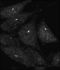 UVRAG Antibody - Immunofluorescence staining of Autophagy UVRAG antibody on Methanol-fixed HeLa cells. Data courtesy of Dr. Eeva-Liisa Eskelinen, University of Helsinki,Finland.
