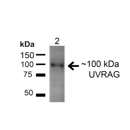 UVRAG Antibody - Western blot analysis of Rat Liver showing detection of ~100kDa UVRAG protein using Rabbit Anti-UVRAG Polyclonal Antibody. Lane 1: MW Ladder. Lane 2: Rat Liver (20 µg). Load: 20 µg. Block: 5% Skim Milk for 1 hour at RT. Primary Antibody: Rabbit Anti-UVRAG Polyclonal Antibody  at 1:200 for 1 hour at RT. Secondary Antibody: Goat Anti-Rabbit IgG: HRP at 1:2000 for 1 hour at RT. Color Development: ECL solution for 6 min at RT. Predicted/Observed Size: ~100kDa.