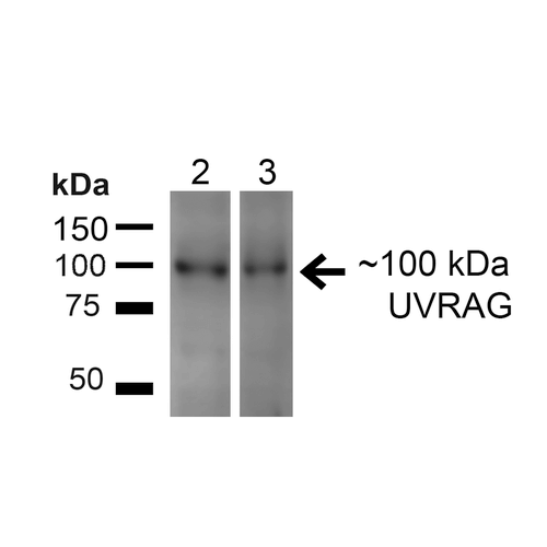 UVRAG Antibody - Western blot analysis of Human HeLa and HEK293T cell lysates showing detection of ~100kDa UVRAG protein using Rabbit Anti-UVRAG Polyclonal Antibody. Lane 1: MW Ladder. Lane 2: Human HeLa (20 µg). Lane 3: Human 293T (20 µg). Load: 20 µg. Block: 5% Skim Milk for 1 hour at RT. Primary Antibody: Rabbit Anti-UVRAG Polyclonal Antibody  at 1:200 for 1 hour at RT. Secondary Antibody: Goat Anti-Rabbit IgG: HRP at 1:2000 for 1 hour at RT. Color Development: ECL solution for 6 min at RT. Predicted/Observed Size: ~100kDa.