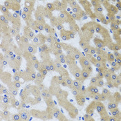 UVRAG Antibody - Immunohistochemistry of paraffin-embedded human liver injury using UVRAG antibody at dilution of 1:100 (x40 lens).