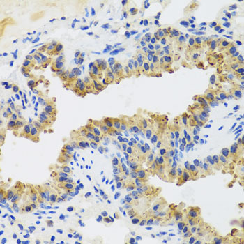 UVRAG Antibody - Immunohistochemistry of paraffin-embedded mouse lung using UVRAG antibody at dilution of 1:100 (x40 lens).