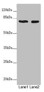 UVRAG Antibody - Western blot All Lanes :UVRAG antibody at 2 ug/ml Lane 1 : SH-SY5Y whole cell lysate Lane 2 : 293T whole cell lysate Secondary Goat polyclonal to rabbit IgG at 1/10000 dilution Predicted band size: 79,36 kDa Observed band size: 78 kDa