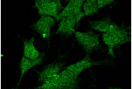 UVRAG Antibody - Detection of UVRAG in formaldehyde-fixed neuroblastoma SK-N-BE cells.