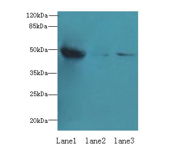 UXS1 Antibody - Western blot. All lanes: UXS1 antibody at 6 ug/ml. Lane 1: Mouse lung tissue. Lane 2: Jurkat whole cell lysate. Lane 3: HepG-2 whole cell lysate. Secondary antibody: Goat polyclonal to Rabbit IgG at 1:10000 dilution. Predicted band size: 48 kDa. Observed band size: 48 kDa.