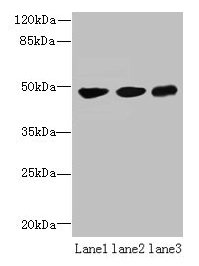 UXS1 Antibody - Western blot All lanes: UXS1 antibody at 6µg/ml Lane 1: Mouse lung tissue Lane 2: Jurkat whole cell lysate Lane 3: HepG2 whole cell lysate Secondary Goat polyclonal to rabbit IgG at 1/10000 dilution Predicted band size: 48, 49, 29 kDa Observed band size: 48 kDa