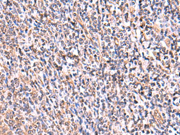 UXS1 Antibody - Immunohistochemistry of paraffin-embedded Human tonsil tissue  using UXS1 Polyclonal Antibody at dilution of 1:60(×200)