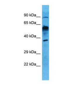 UXS1 Antibody - Western blot of Human Lung Tumor. UXS1 antibody dilution 1.0 ug/ml.  This image was taken for the unconjugated form of this product. Other forms have not been tested.