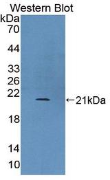 UXT Antibody - Western blot of UXT antibody.