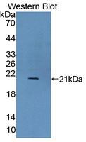 UXT Antibody - Western blot of UXT antibody.