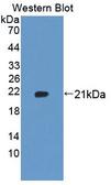 UXT Antibody - Western blot of UXT antibody.