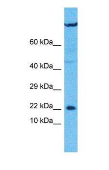 UXT Antibody - Western blot of UXT Antibody with human U937 Whole Cell lysate.  This image was taken for the unconjugated form of this product. Other forms have not been tested.