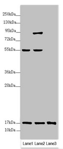UXT Antibody - Western blot All Lanes:UXT antibody at 3.2 ug/ml Lane 1: HL60 whole cell lysate Lane 2: 293T whole cell lysate Lane 3: Hela whole cell lysate Secondary Goat polyclonal to rabbit IgG at 1/10000 dilution Predicted band size: 18 kDa Observed band size: 18,80,55 kDa